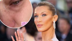Bella Hadid Tears Up as She Details Chronic Illness From Lyme Disease