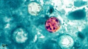 NC cyclosporiasis cases do not appear to be linked to Taco Bell, says DHHS